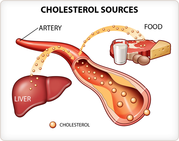 All About Cholesterol