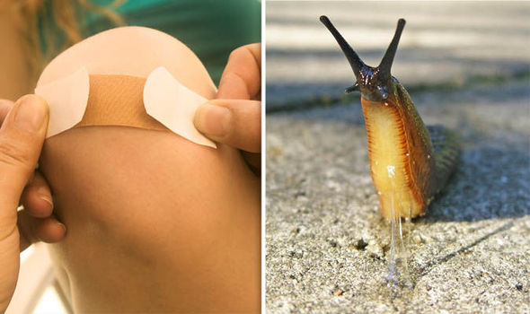 Lifesaving Medical Glue Inspired By Slimy Slugs