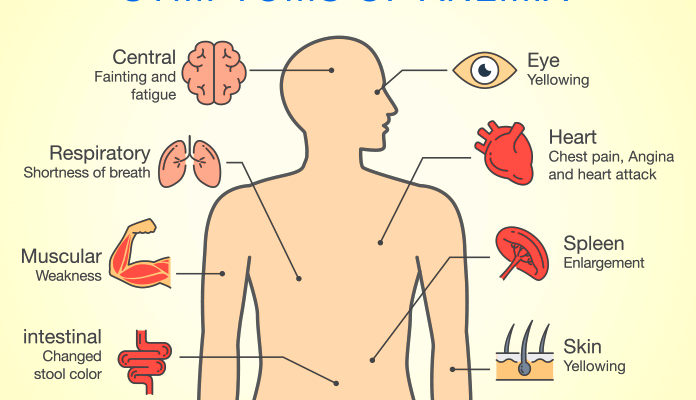 What is Anemia