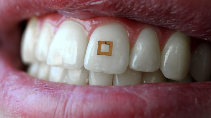 dental sensor
