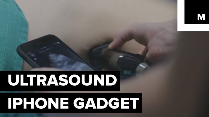 iPhone Ultrasound Device