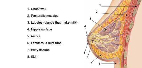 What is breast cancer