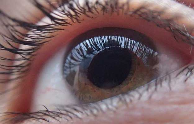Miosis or Pinpoint Pupils Eyes Condition