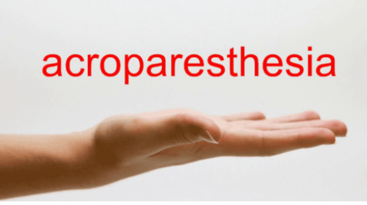 What is Acroparesthesia