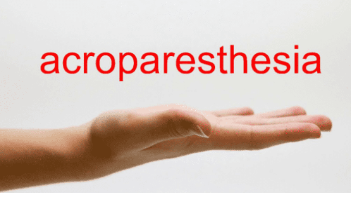 What is Acroparesthesia