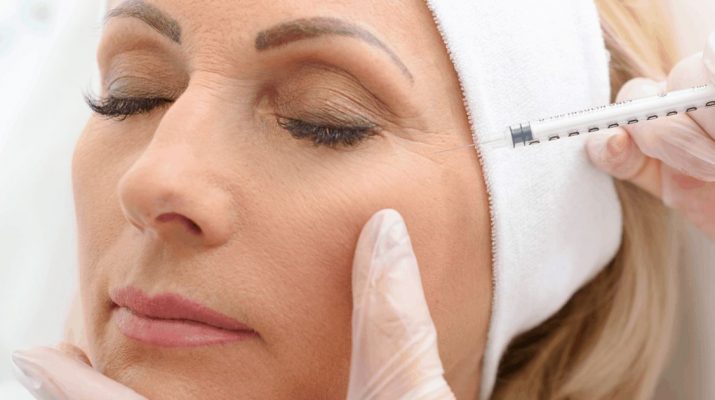 botox treatment