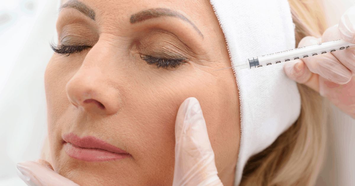 botox treatment