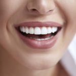 Find a Cosmetic Dentist in Australia