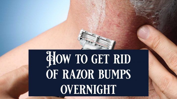 How To Get Rid Of Razor Bumps