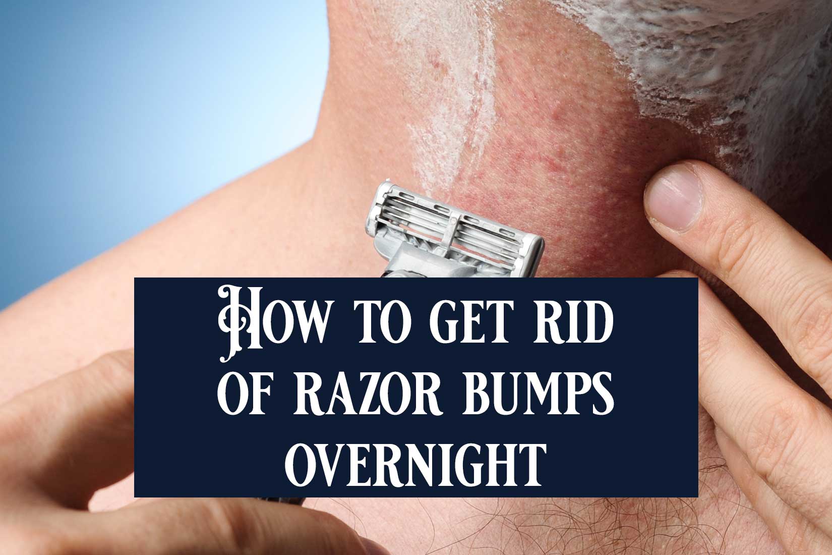 How To Get Rid Of Razor Bumps