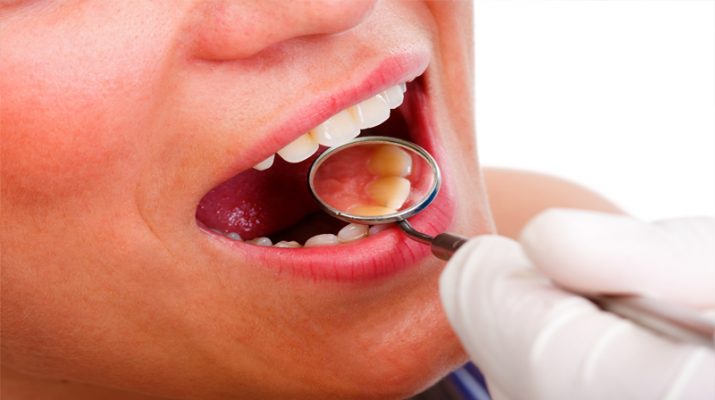 Gateway to Dental Health