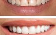 Cosmetic Dentistry Excellence in London