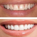 Cosmetic Dentistry Excellence in London