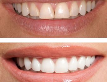 Cosmetic Dentistry Excellence in London